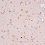 Immunohistochemistry - Anti-KDM6B / JMJD3 Antibody (A88509) - Antibodies.com