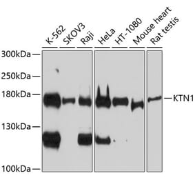 Western Blot - Anti-Kinectin 1 Antibody (A88510) - Antibodies.com