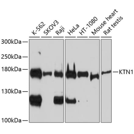 Western Blot - Anti-Kinectin 1 Antibody (A88510) - Antibodies.com