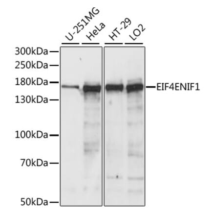 Western Blot - Anti-4E-T Antibody (A88511) - Antibodies.com