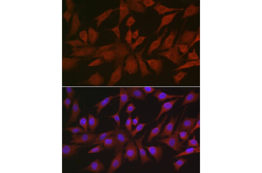 Immunofluorescence - Anti-4E-T Antibody (A88511) - Antibodies.com