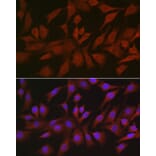 Immunofluorescence - Anti-4E-T Antibody (A88511) - Antibodies.com