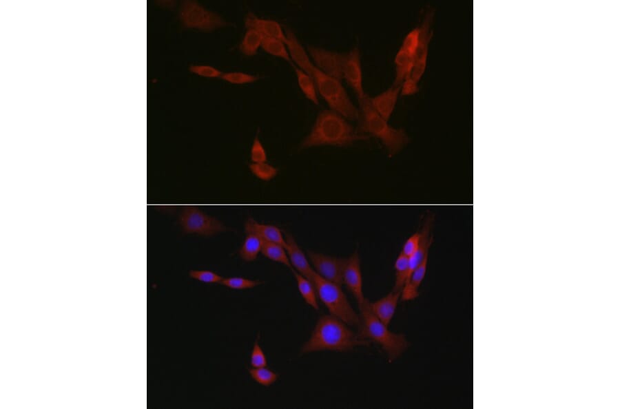 Immunofluorescence - Anti-4E-T Antibody (A88511) - Antibodies.com