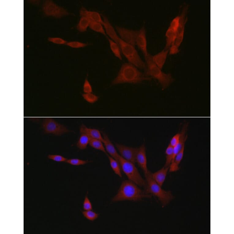 Immunofluorescence - Anti-4E-T Antibody (A88511) - Antibodies.com