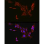 Immunofluorescence - Anti-4E-T Antibody (A88511) - Antibodies.com
