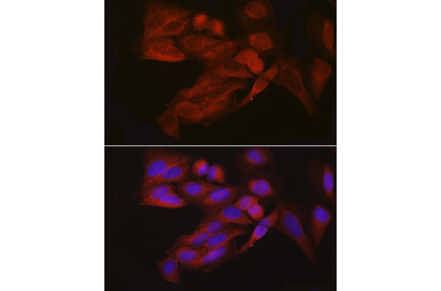Immunofluorescence - Anti-4E-T Antibody (A88511) - Antibodies.com