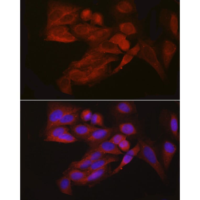 Immunofluorescence - Anti-4E-T Antibody (A88511) - Antibodies.com