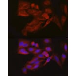 Immunofluorescence - Anti-4E-T Antibody (A88511) - Antibodies.com