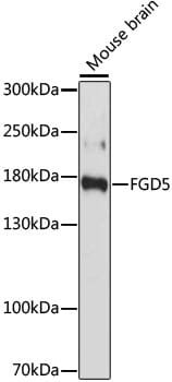 Western blot analysis of extracts of Mouse brain, using Anti-FGD5 Antibody (A15212) at 1:1,000 dilution.
Secondary antibody: Goat Anti-Rabbit IgG (H+L) (HRP) (AS014) at 1:10,000 dilution.
Lysates / proteins: 25µg per lane.
Blocking buffer: 3% non-fat dry milk in TBST.
Detection: ECL Basic Kit (RM00020).
Exposure time: 60s.