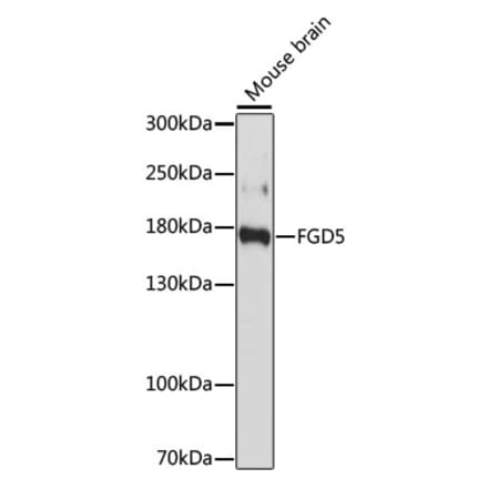 Western Blot - Anti-FGD5 Antibody (A88512) - Antibodies.com