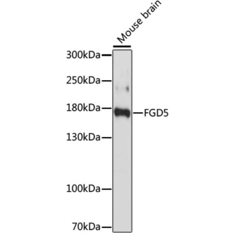 Western Blot - Anti-FGD5 Antibody (A88512) - Antibodies.com