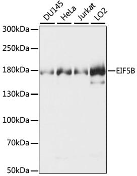 Western blot analysis of extracts of various cell lines, using Anti-EIF5B Antibody (A15123).
Secondary antibody: Goat Anti-Rabbit IgG (H+L) (HRP) (AS014) at 1:10,000 dilution.
Lysates / proteins: 25µg per lane.
Blocking buffer: 3% non-fat dry milk in TBST.
Detection: ECL Basic Kit (RM00020).
Exposure time: 3s.