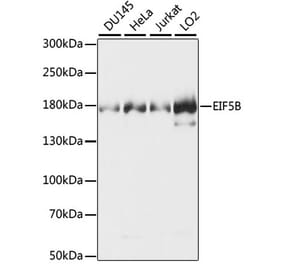 Western Blot - Anti-EIF5B Antibody (A88513) - Antibodies.com