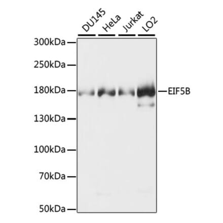 Western Blot - Anti-EIF5B Antibody (A88513) - Antibodies.com