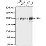 Western Blot - Anti-EIF5B Antibody (A88513) - Antibodies.com