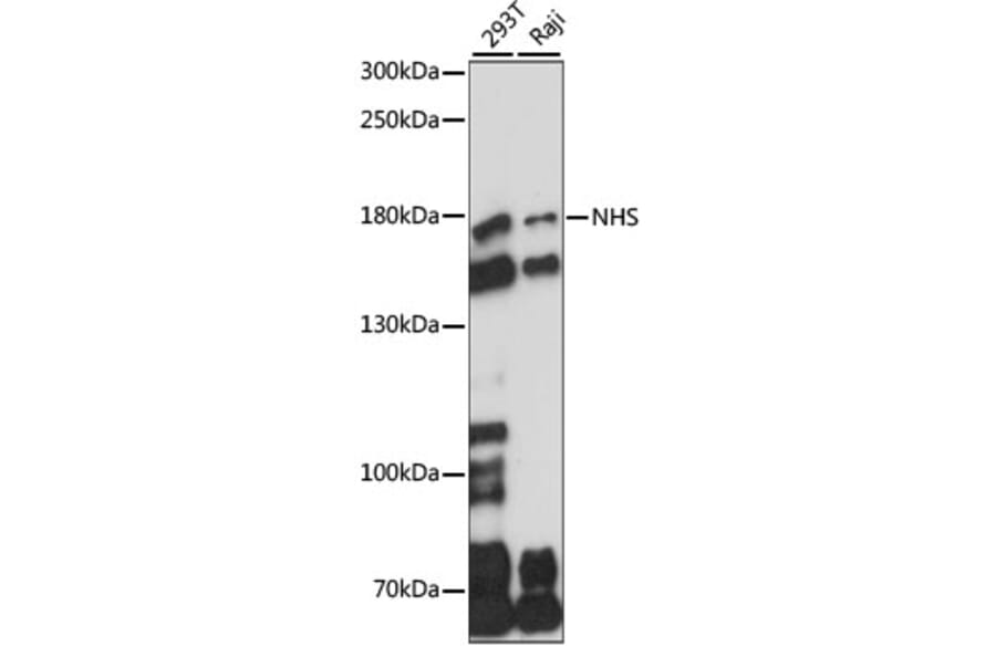 Western Blot - Anti-Nance-Horan Syndrome Protein Antibody (A88514) - Antibodies.com