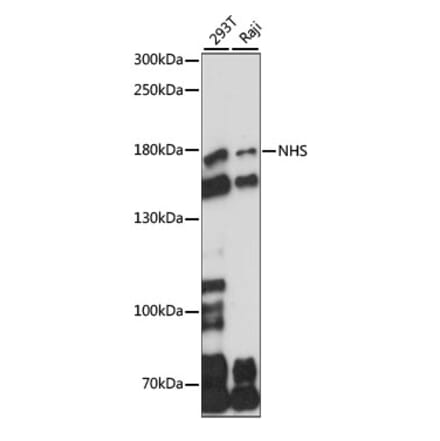 Western Blot - Anti-Nance-Horan Syndrome Protein Antibody (A88514) - Antibodies.com