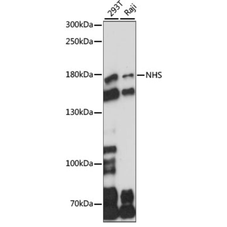 Western Blot - Anti-Nance-Horan Syndrome Protein Antibody (A88514) - Antibodies.com
