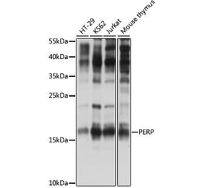 Western Blot - Anti-PERP Antibody (A88515) - Antibodies.com