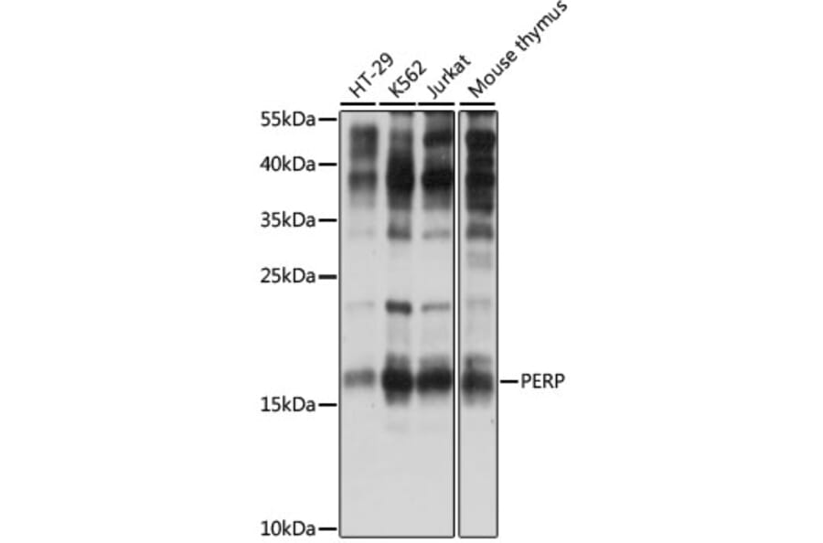 Western Blot - Anti-PERP Antibody (A88515) - Antibodies.com