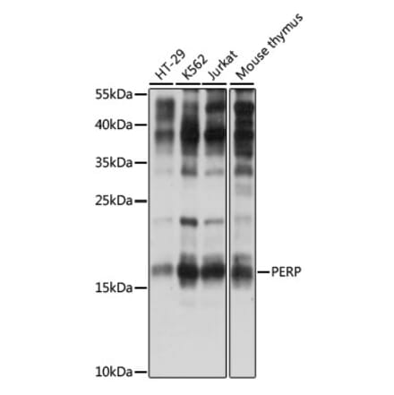 Western Blot - Anti-PERP Antibody (A88515) - Antibodies.com