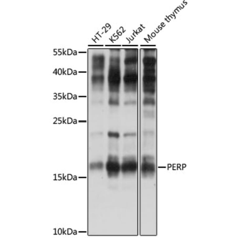 Western Blot - Anti-PERP Antibody (A88515) - Antibodies.com