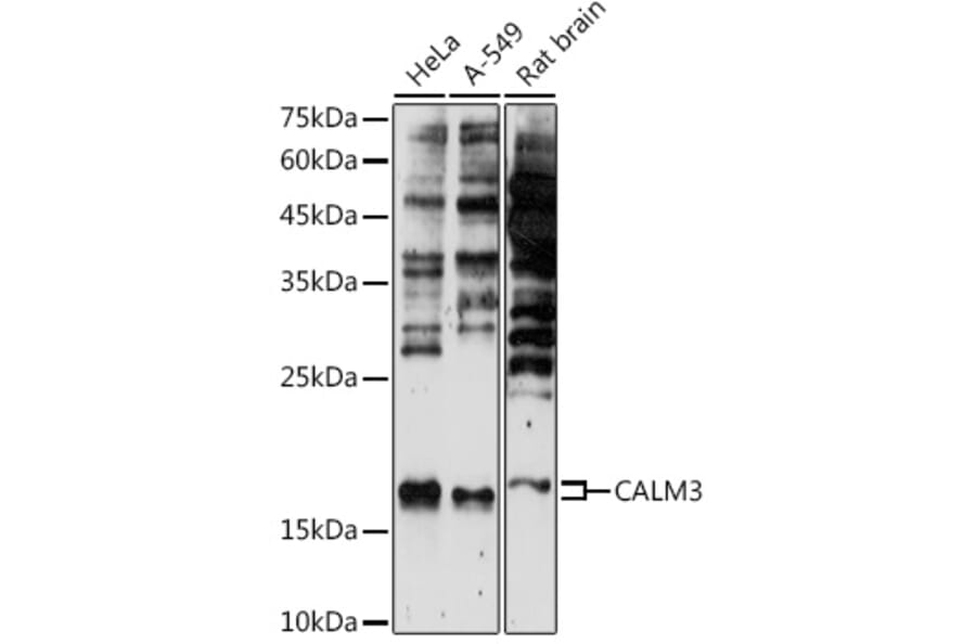 Western Blot - Anti-Calmodulin 1/2/3 Antibody (A88516) - Antibodies.com