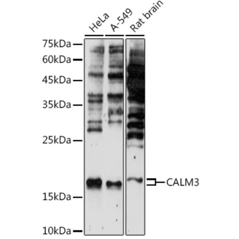 Western Blot - Anti-Calmodulin 1/2/3 Antibody (A88516) - Antibodies.com