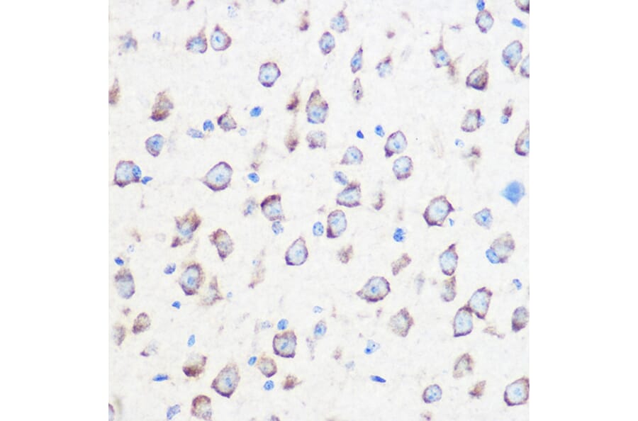 Immunohistochemistry - Anti-Calmodulin 1/2/3 Antibody (A88516) - Antibodies.com