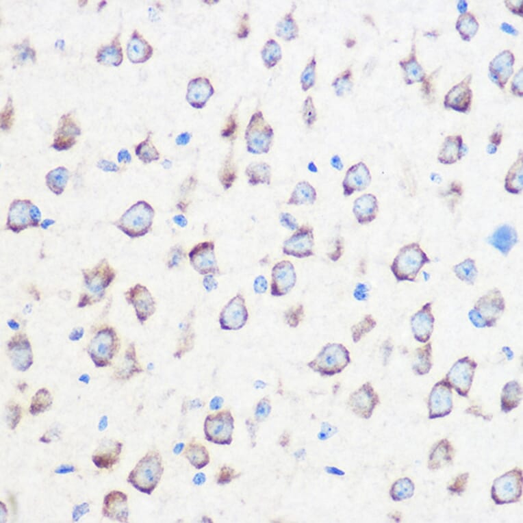 Immunohistochemistry - Anti-Calmodulin 1/2/3 Antibody (A88516) - Antibodies.com