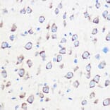 Immunohistochemistry - Anti-Calmodulin 1/2/3 Antibody (A88516) - Antibodies.com