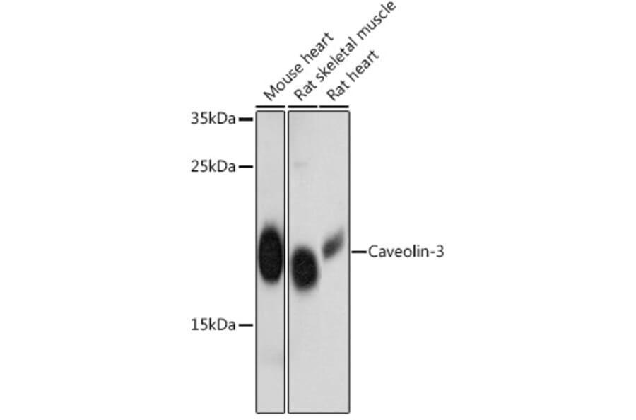 Western Blot - Anti-Caveolin-3 Antibody (A88517) - Antibodies.com