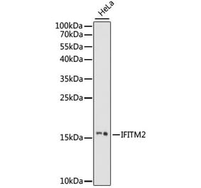 Western Blot - Anti-IFITM2 Antibody (A88518) - Antibodies.com