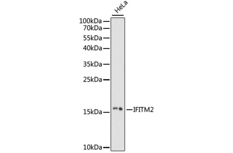 Western Blot - Anti-IFITM2 Antibody (A88518) - Antibodies.com