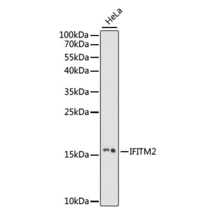 Western Blot - Anti-IFITM2 Antibody (A88518) - Antibodies.com