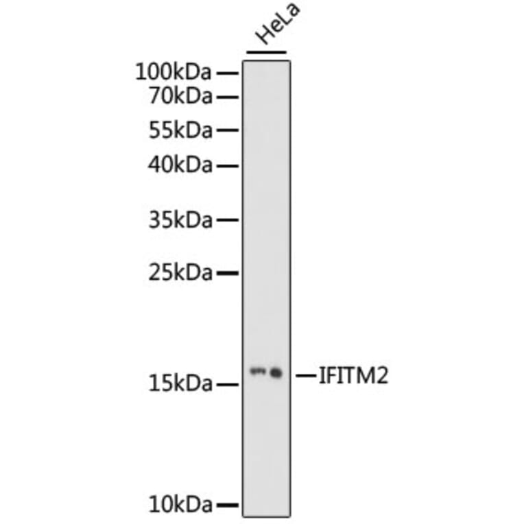 Western Blot - Anti-IFITM2 Antibody (A88518) - Antibodies.com