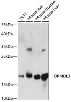 Western blot analysis of extracts of various cell lines, using Anti-ORMDL3 Antibody (A14951) at 1:1,000 dilution.
Secondary antibody: Goat Anti-Rabbit IgG (H+L) (HRP) (AS014) at 1:10,000 dilution.
Lysates / proteins: 25µg per lane.
Blocking buffer: 3% non-fat dry milk in TBST.
Detection: ECL Enhanced Kit (RM00021).
Exposure time: 60s.