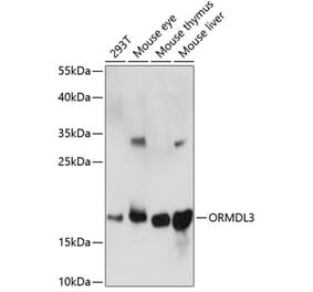 Western Blot - Anti-ORMDL3 Antibody (A88519) - Antibodies.com