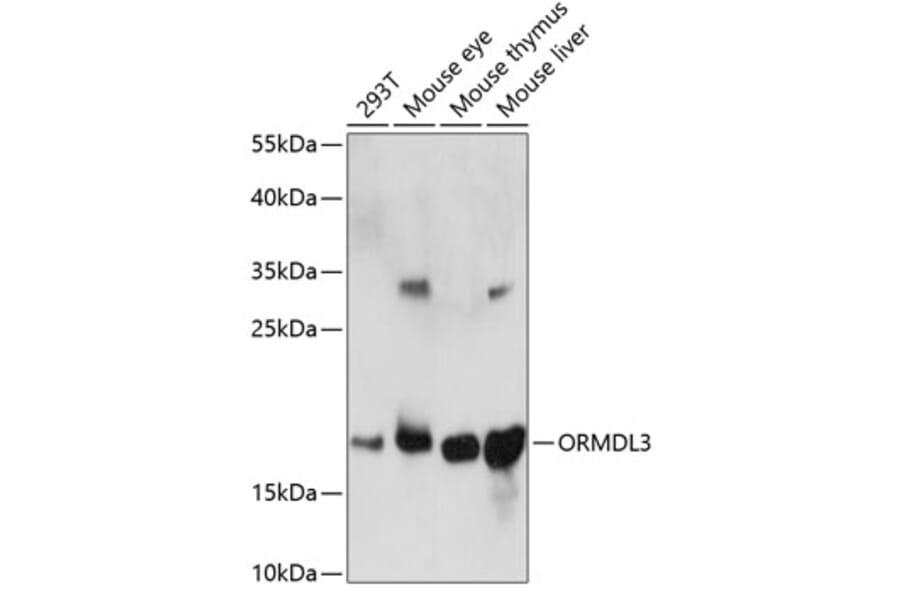 Western Blot - Anti-ORMDL3 Antibody (A88519) - Antibodies.com