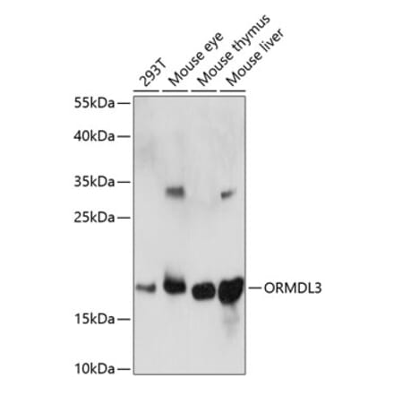 Western Blot - Anti-ORMDL3 Antibody (A88519) - Antibodies.com
