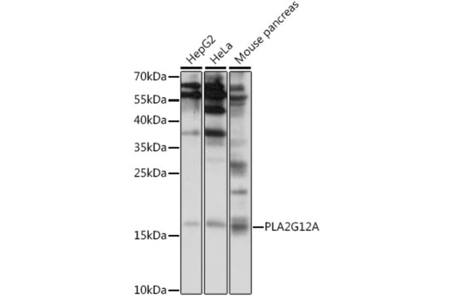 Western Blot - Anti-Phospholipase A2 XII/PLA2G12A Antibody (A88520) - Antibodies.com