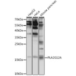Western Blot - Anti-Phospholipase A2 XII/PLA2G12A Antibody (A88520) - Antibodies.com