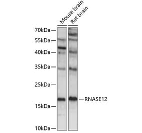 Western Blot - Anti-RNASE12 Antibody (A88521) - Antibodies.com