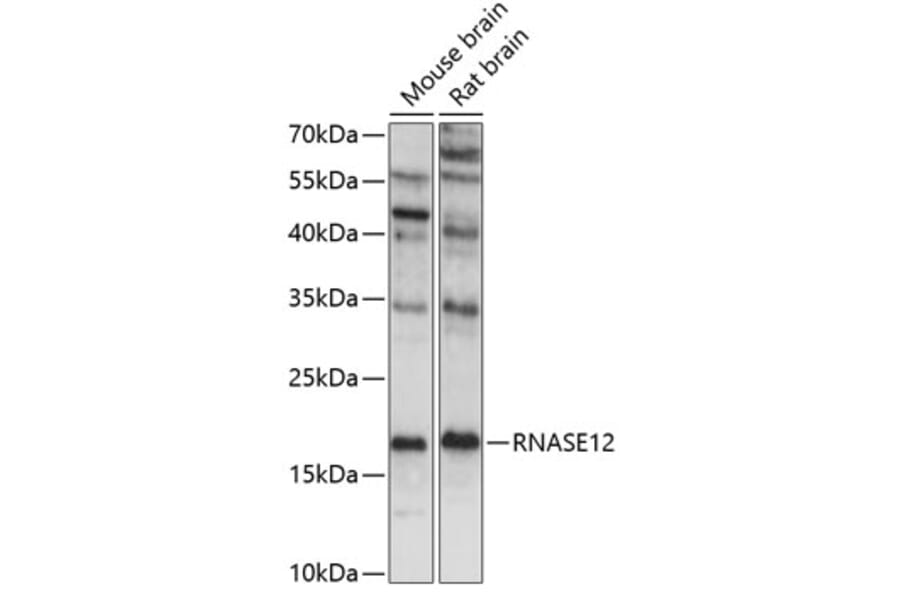 Western Blot - Anti-RNASE12 Antibody (A88521) - Antibodies.com