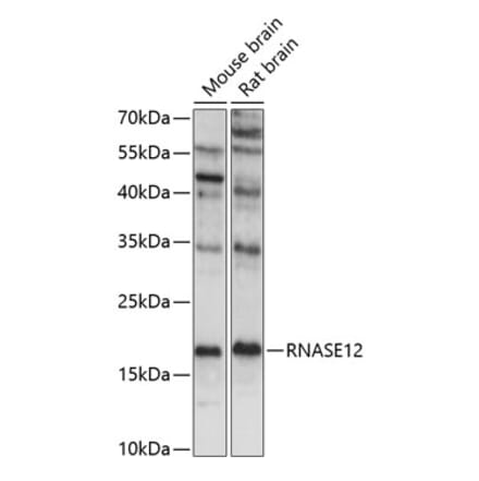 Western Blot - Anti-RNASE12 Antibody (A88521) - Antibodies.com