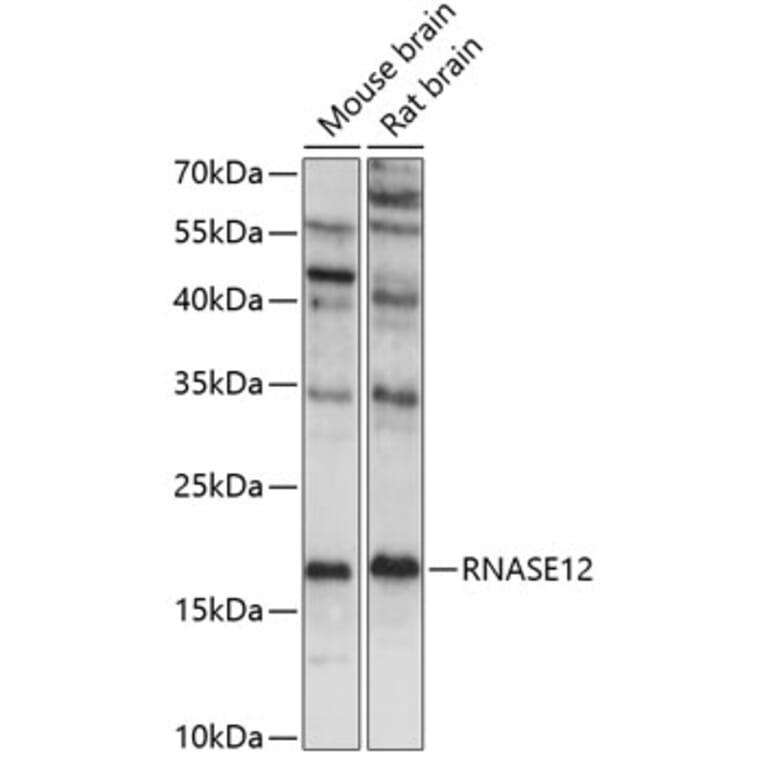 Western Blot - Anti-RNASE12 Antibody (A88521) - Antibodies.com