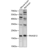 Western Blot - Anti-RNASE12 Antibody (A88521) - Antibodies.com