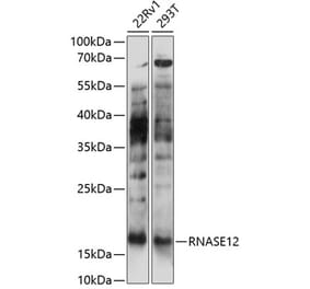 Western Blot - Anti-RNASE12 Antibody (A88522) - Antibodies.com