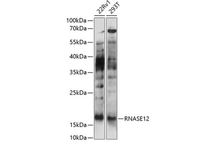 Western Blot - Anti-RNASE12 Antibody (A88522) - Antibodies.com