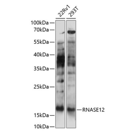 Western Blot - Anti-RNASE12 Antibody (A88522) - Antibodies.com